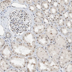 Immunohistochemical staining of human kidney shows moderate nuclear positivity in cells in tubules and cells in glomeruli.