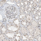 Immunohistochemical staining of human kidney shows moderate nuclear positivity in cells in tubules and cells in glomeruli.