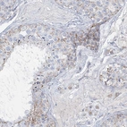 Immunohistochemical staining of human testis shows weak to moderate granular cytoplasmic positivity in cells in seminiferous ducts.