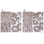 Anti-GFM1 Antibody