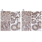 Anti-GFM1 Antibody
