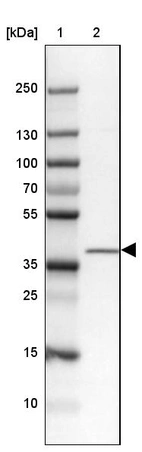 Lane 1: Marker [kDa] 250, 130, 100, 70, 55, 35, 25, 15, 10_br/_Lane 2: Human cell line MOLT-4