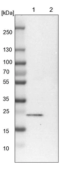 Lane 1: NIH-3T3 cell lysate (Mouse embryonic fibroblast cells)_br/_Lane 2: NBT-II cell lysate (Rat Wistar bladder tumour cells)
