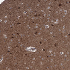 Immunohistochemical staining of human Cerebral cortex shows moderate cytoplasmic positivity in neuronal cells.