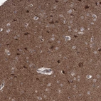 Immunohistochemical staining of human Cerebral cortex shows moderate cytoplasmic positivity in neuronal cells.