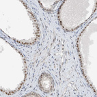 Immunohistochemical staining of human prostate shows moderate nuclear positivity in glandular cells.
