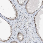 Immunohistochemical staining of human prostate shows moderate nuclear positivity in glandular cells.