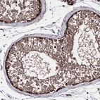 Immunohistochemical staining of human testis shows strong granular cytoplasmic positivity in cells in seminiferous ducts.