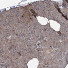 Immunohistochemical staining of human Pancreas shows moderate cytoplasmic positivity in islets of Langerhans and exocrine glandular cells.