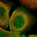 Immunofluorescent staining of human cell line A-431 shows localization to nucleoplasm & plasma membrane.
