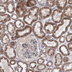 Immunohistochemical staining of human kidney shows moderate granular cytoplasmic positivity in cells in tubules.