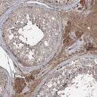 Immunohistochemical staining of human Testis shows moderate cytoplasmic positivity in Leydig cells and cells in seminiferous ducts.