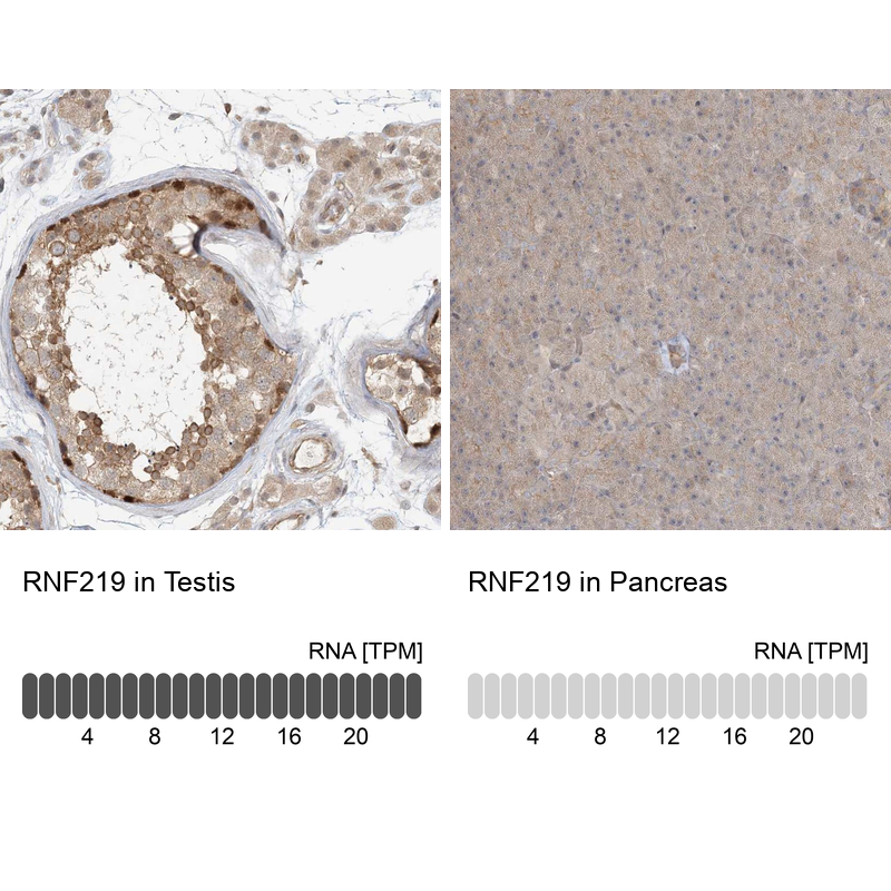 Anti-RNF219 Antibody