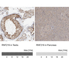 Anti-RNF219 Antibody