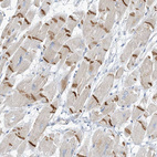 Anti-XIRP2 Antibody