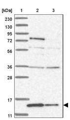 Lane 1: Marker [kDa] 230, 130, 95, 72, 56, 36, 28, 17, 11_br/_Lane 2: Human cell line RT-4_br/_Lane 3: Human cell line U-251MG sp