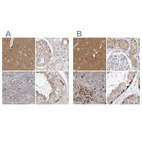 Immunohistochemical staining of human cerebral cortex, kidney, lymph node and testis using Anti-RNF219 antibody HPA034785 (A) shows similar protein distribution across tissues to independent antibody HPA034786 (B).