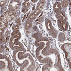 Immunohistochemical staining of human stomach shows moderate granular cytoplasmic positivity in glandular cells.