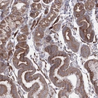 Immunohistochemical staining of human stomach shows moderate granular cytoplasmic positivity in glandular cells.