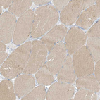 Immunohistochemical staining of human skeletal muscle shows weak cytoplasmic positivity in myocytes.