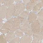 Immunohistochemical staining of human skeletal muscle shows weak cytoplasmic positivity in myocytes.