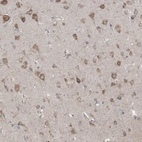 Immunohistochemical staining of human cerebral cortex shows moderate granular cytoplasmic positivity in neurons.