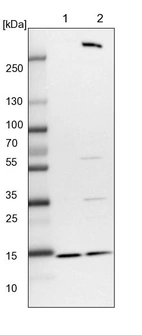 Lane 1: NIH-3T3 cell lysate (Mouse embryonic fibroblast cells)_br/_Lane 2: NBT-II cell lysate (Rat Wistar bladder tumour cells)