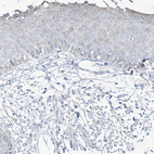 Immunohistochemical staining of human skin shows low cytoplasmic positivity in squamous epithelial cells as expected.