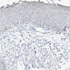 Immunohistochemical staining of human skin shows low cytoplasmic positivity in squamous epithelial cells as expected.