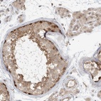 Immunohistochemical staining of human testis shows high expression.