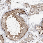 Immunohistochemical staining of human testis shows high expression.