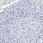 Immunohistochemical staining of human lymph node shows no positivity in germinal center cells as expected.