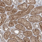 Immunohistochemical staining of human kidney shows moderate granular cytoplasmic positivity in cells in tubules.