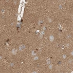 Immunohistochemical staining of human cerebral cortex using Anti-RNF219 antibody HPA034785.