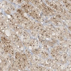 Anti-ZBTB41 Antibody