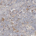 Immunohistochemical staining of human lymph node using Anti-RNF219 antibody HPA034785.