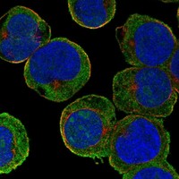 Anti-TMPRSS15 Antibody