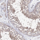 Anti-AURKC Antibody