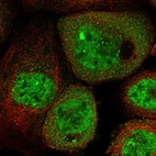 Immunofluorescent staining of human cell line A-431 shows localization to nucleoplasm, nuclear bodies & cytosol.