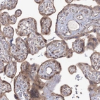 Immunohistochemical staining of human placenta shows moderate cytoplasmic positivity in trophoblastic cells.
