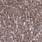 Immunohistochemical staining of human liver shows strong granular cytoplasmic positivity in hepatocytes.