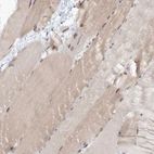 Immunohistochemical staining of human skeletal muscle shows weak cytoplasmic positivity in myocytes.