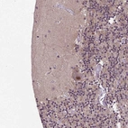 Immunohistochemical staining of human cerebellum shows moderate nuclear positivity in purkinje cells.