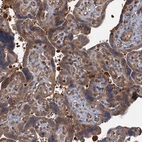 Immunohistochemical staining of human placenta shows moderate cytoplasmic positivity in trophoblastic cells.