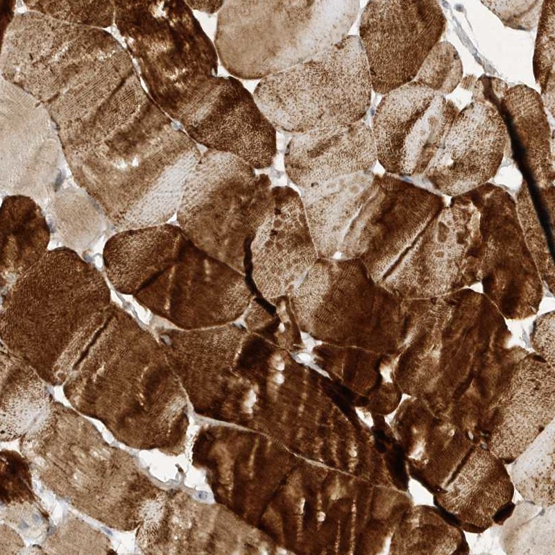 Anti-TAB3 Antibody
