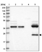 Lane 1: Marker [kDa] 230, 130, 95, 72, 56, 36, 28, 17, 11_br/_Lane 2: Human cell line RT-4_br/_Lane 3: Human cell line U-251MG sp_br/_Lane 4: Human plasma (IgG/HSA depleted)_br/_Lane 5: Human liver tissue