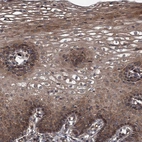 Immunohistochemical staining of human cervix shows moderate cytoplasmic positivity in squamous epithelial cells.