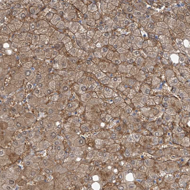 Anti-SLC6A12 Antibody