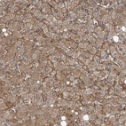 Anti-SLC6A12 Antibody