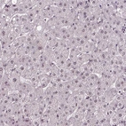 Immunohistochemical staining of human liver shows very weak nuclear positivity in hepatocytes.